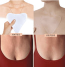 Kit Adesivos Anti-Rugas e Linhas de Expressão