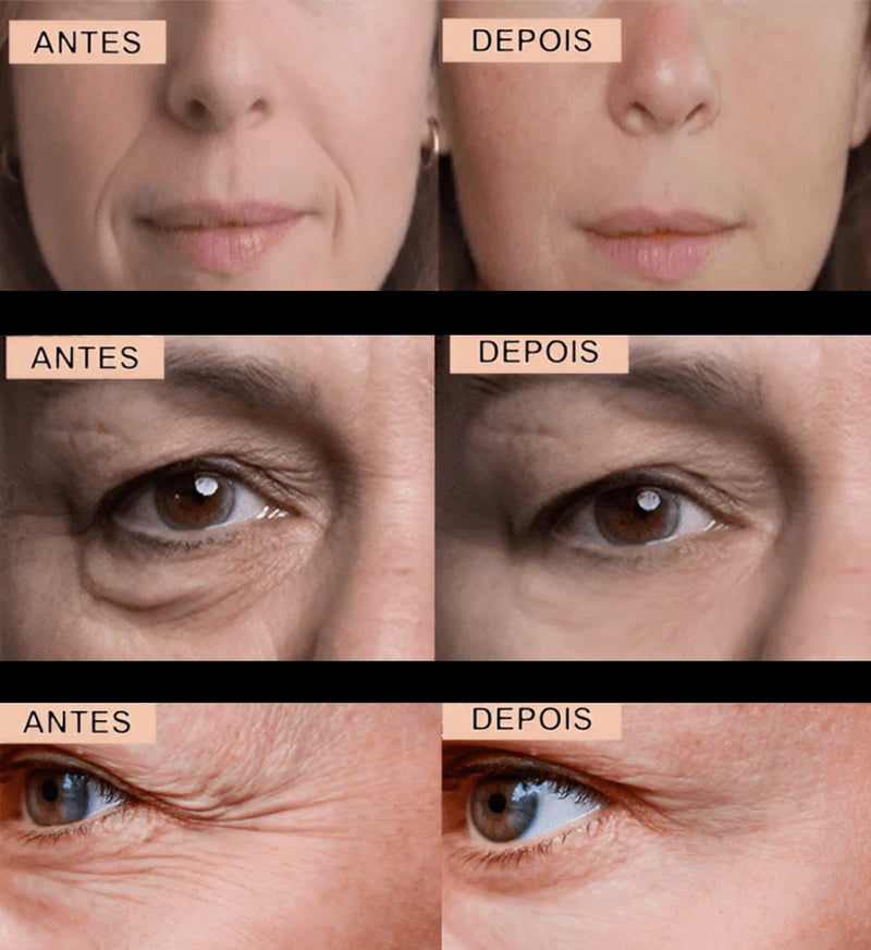 Kit Adesivos Anti-Rugas e Linhas de Expressão
